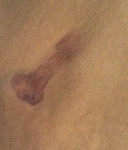 Blood stains