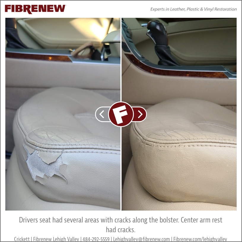 before & after pic 65